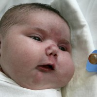 Le plus gros bébé du monde